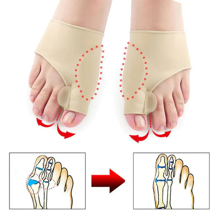 Protección para la Corrección Del Malux Valgus ( 1 Par )