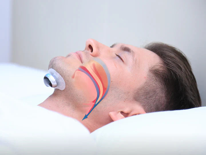 Dispositivo Electrónico Antirronquidos para Dormir Mejor