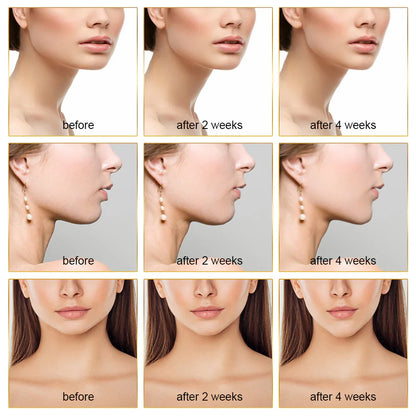 Estimulador Facial Ems con Terapia Led - Lifting Facial y Eliminador de Papada