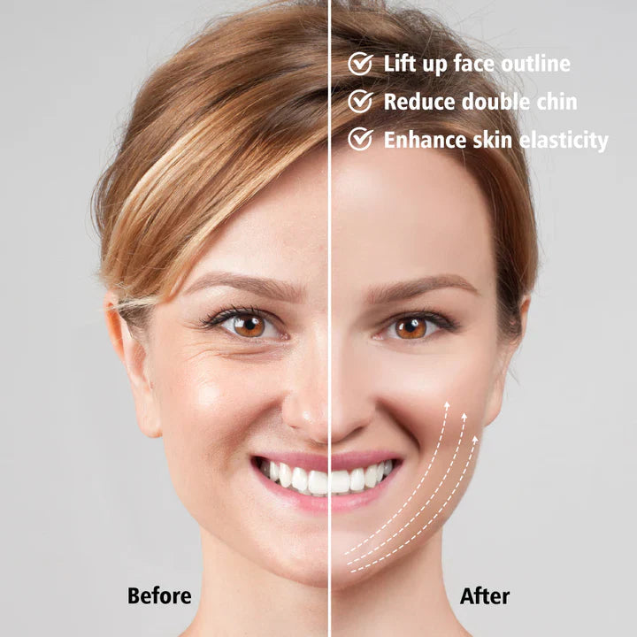 Estimulador Facial Ems con Terapia Led - Lifting Facial y Eliminador de Papada