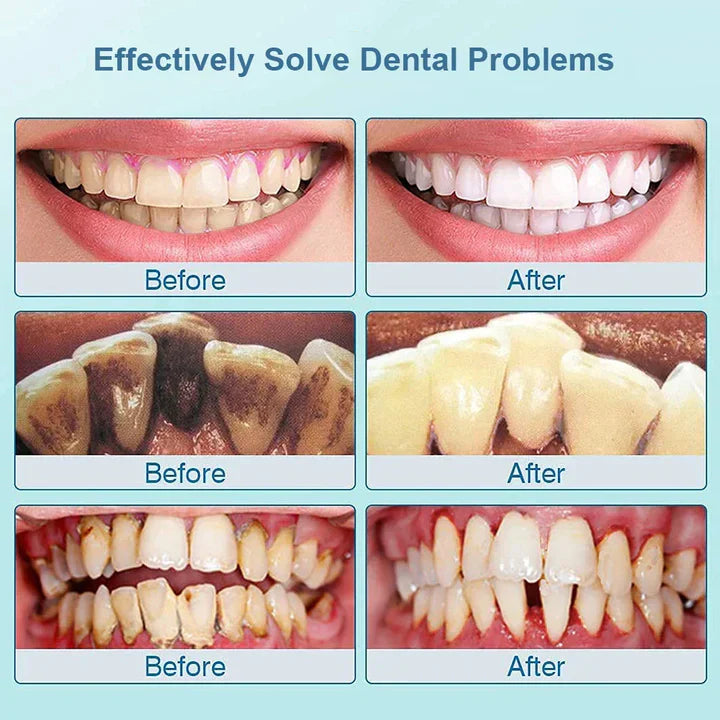 Cepillo de Dientes Sónico Eléctrico