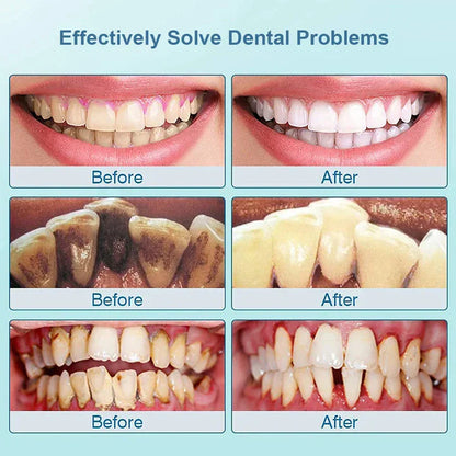 Cepillo de Dientes Sónico Eléctrico