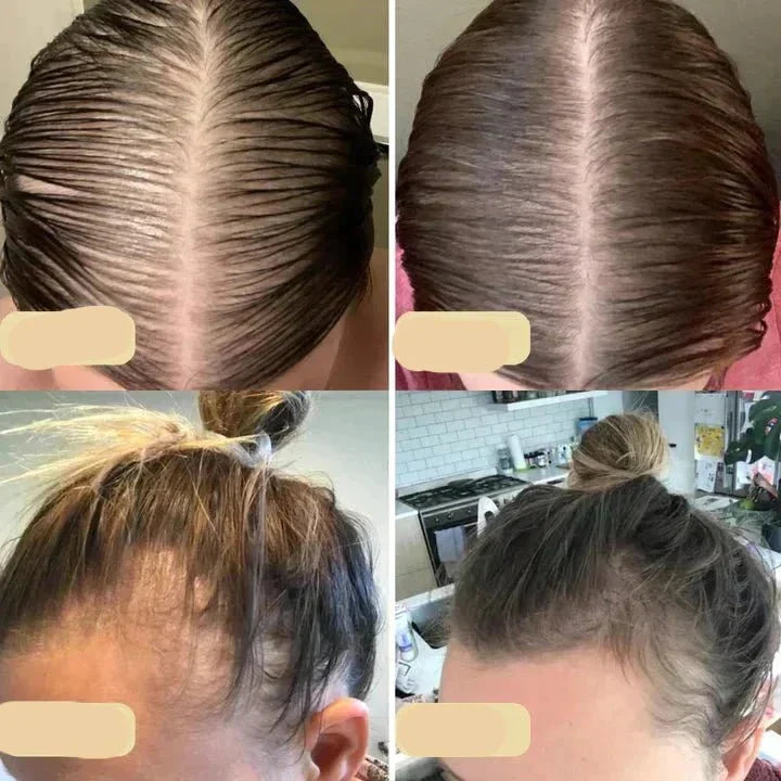 Aceite Vegano para el Crecimiento Del Cabello | Potenciador Natural para un Crecimiento Sano Del Cabello