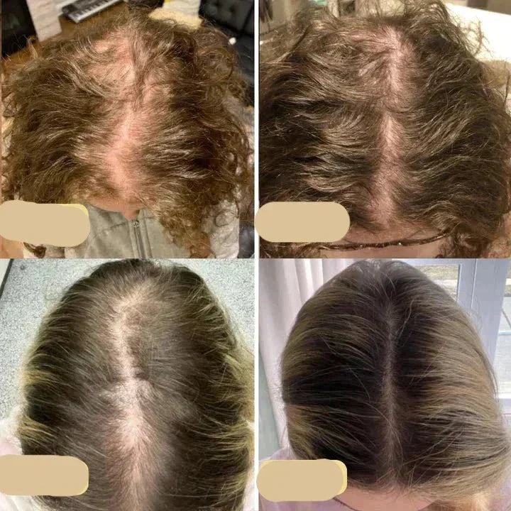 Aceite Vegano para el Crecimiento Del Cabello | Potenciador Natural para un Crecimiento Sano Del Cabello