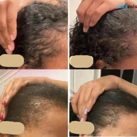Aceite Vegano para el Crecimiento Del Cabello | Potenciador Natural para un Crecimiento Sano Del Cabello